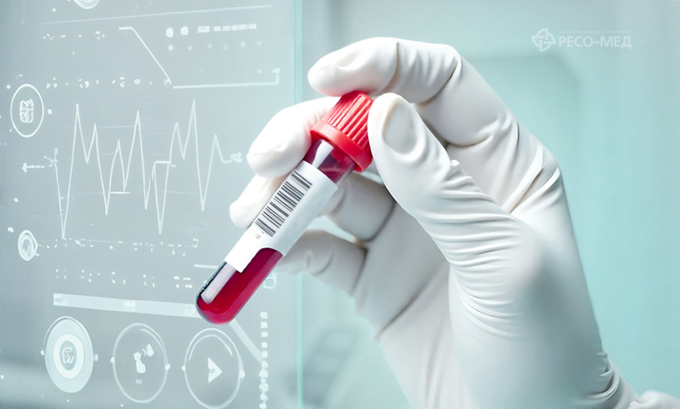 Анализ на сердечно-сосудистые риски стал доступен россиянам по ОМС